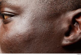 HD Face Skin Kato Abimbo cheek ear eye face skin…